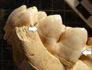 Hypoplasie sur des dents de cochons gaulois